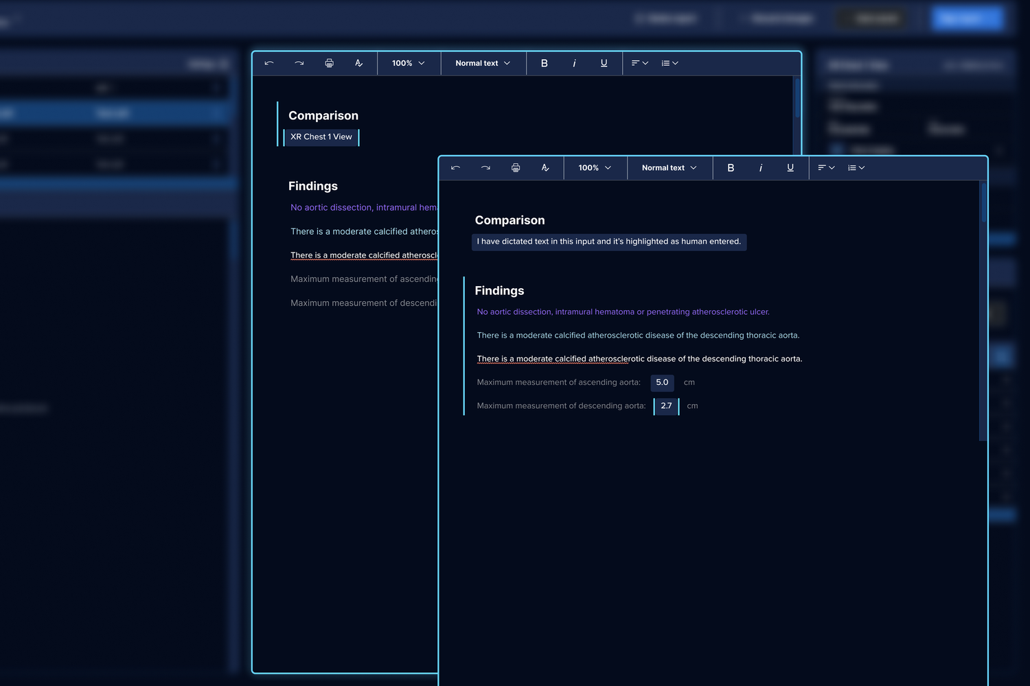 Focused report view with AI-drafted findings.